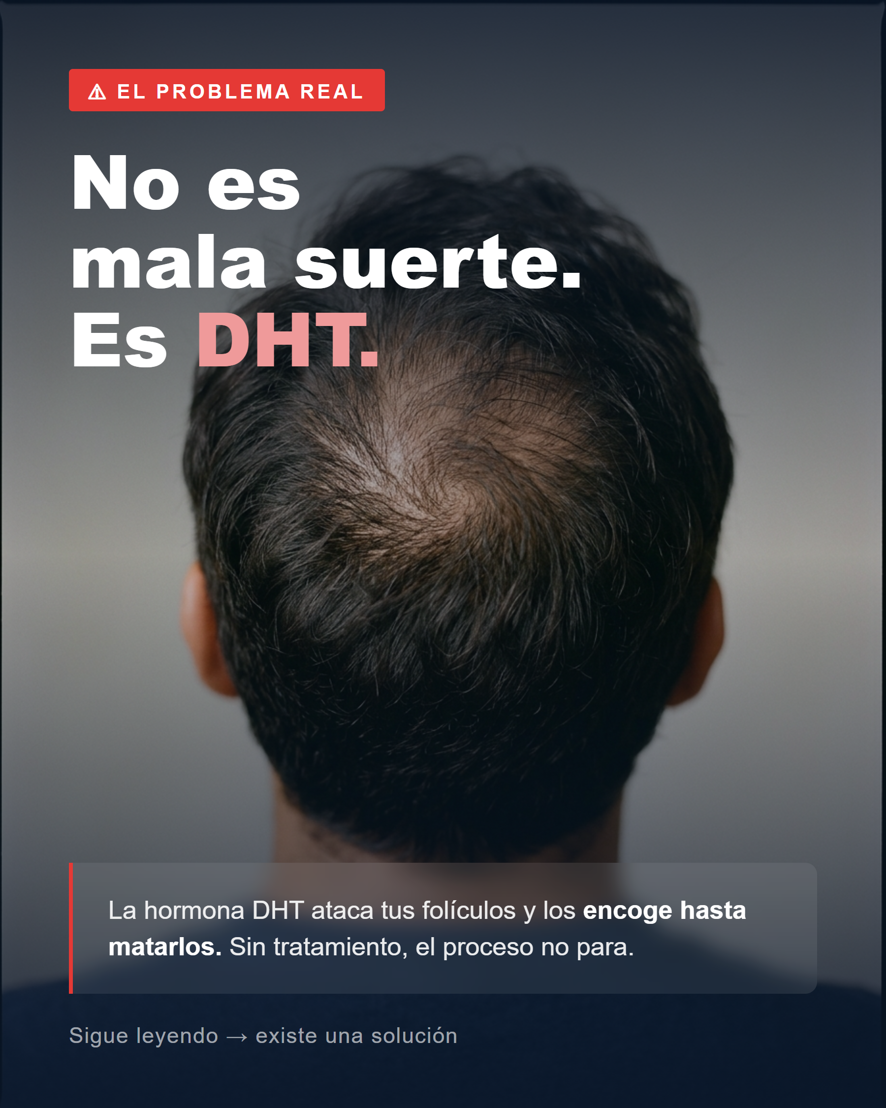 ELLOS™ Cabello Para el DHT. Finasteride + Minoxidil + Biotina. Recupera tu cabello hoy. - Imagen 9