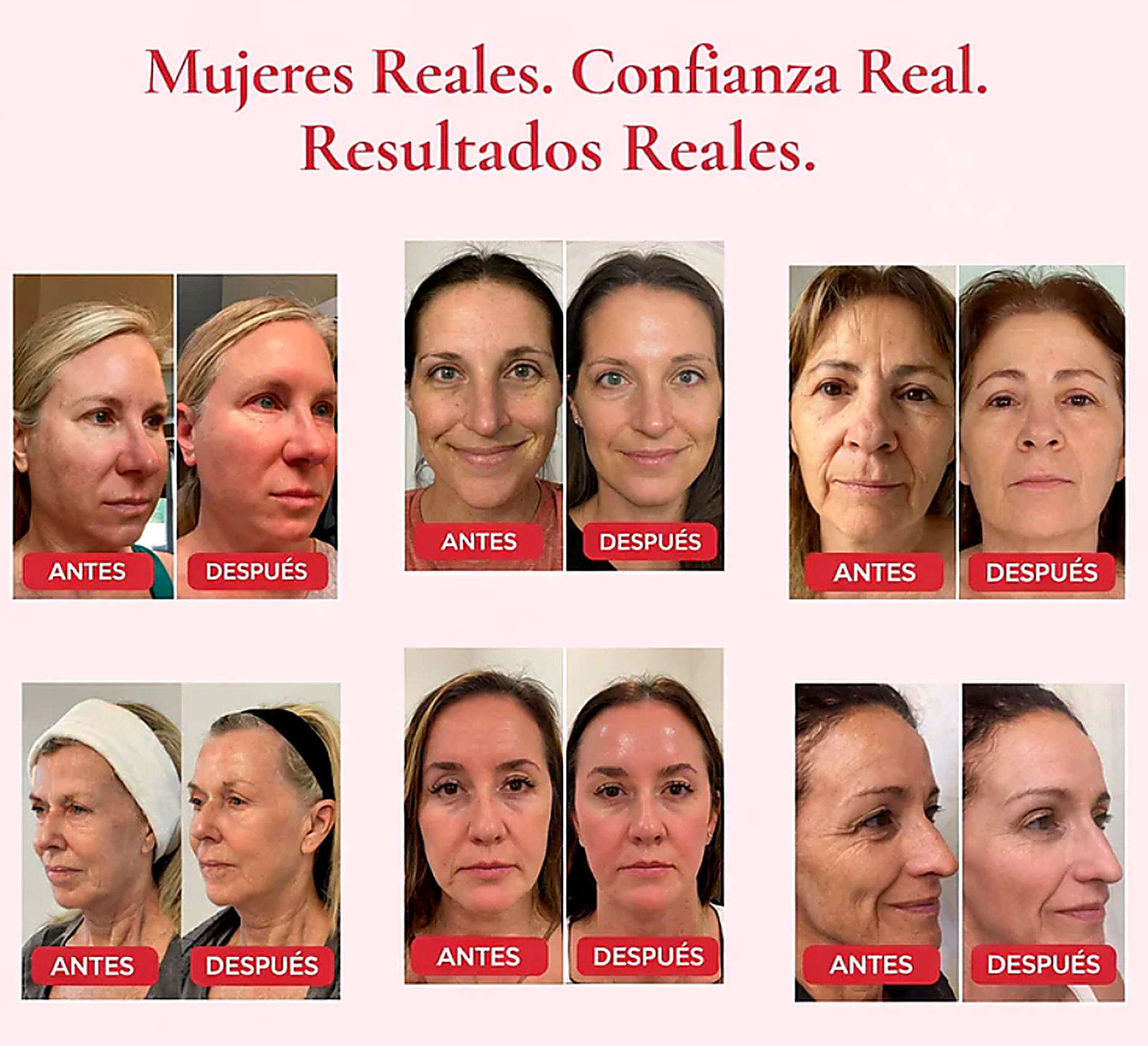 Madeca Cream Time Reverse™ Reparación Coreana con Centella asiatica, mejora la salud de tu piel hoy mismo - Imagen 3